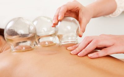 Diving into the Depths of Cupping Therapy: An Acupuncturist’s Guide to Wet, Dry, and Fire Cupping