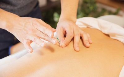 Acupuncture for Chronic Pain: A Natural and Effective Solution