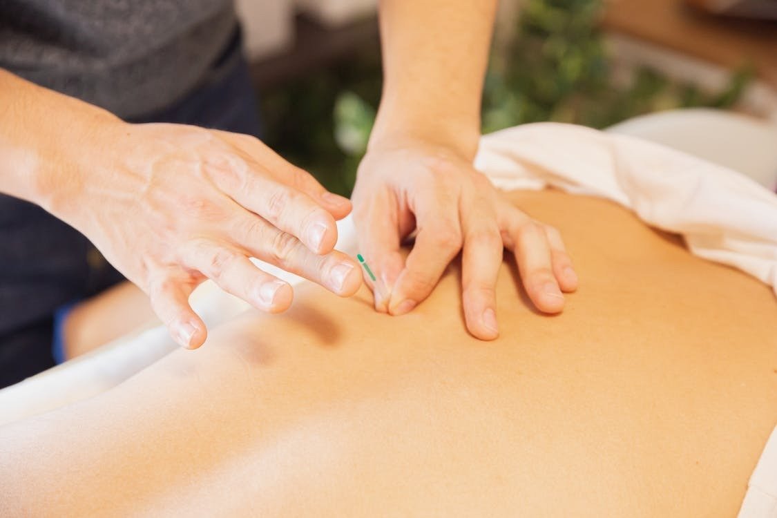 Acupuncture for Chronic Pain: A Natural and Effective Solution