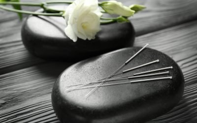 Unlocking the Health Benefits of Acupuncture