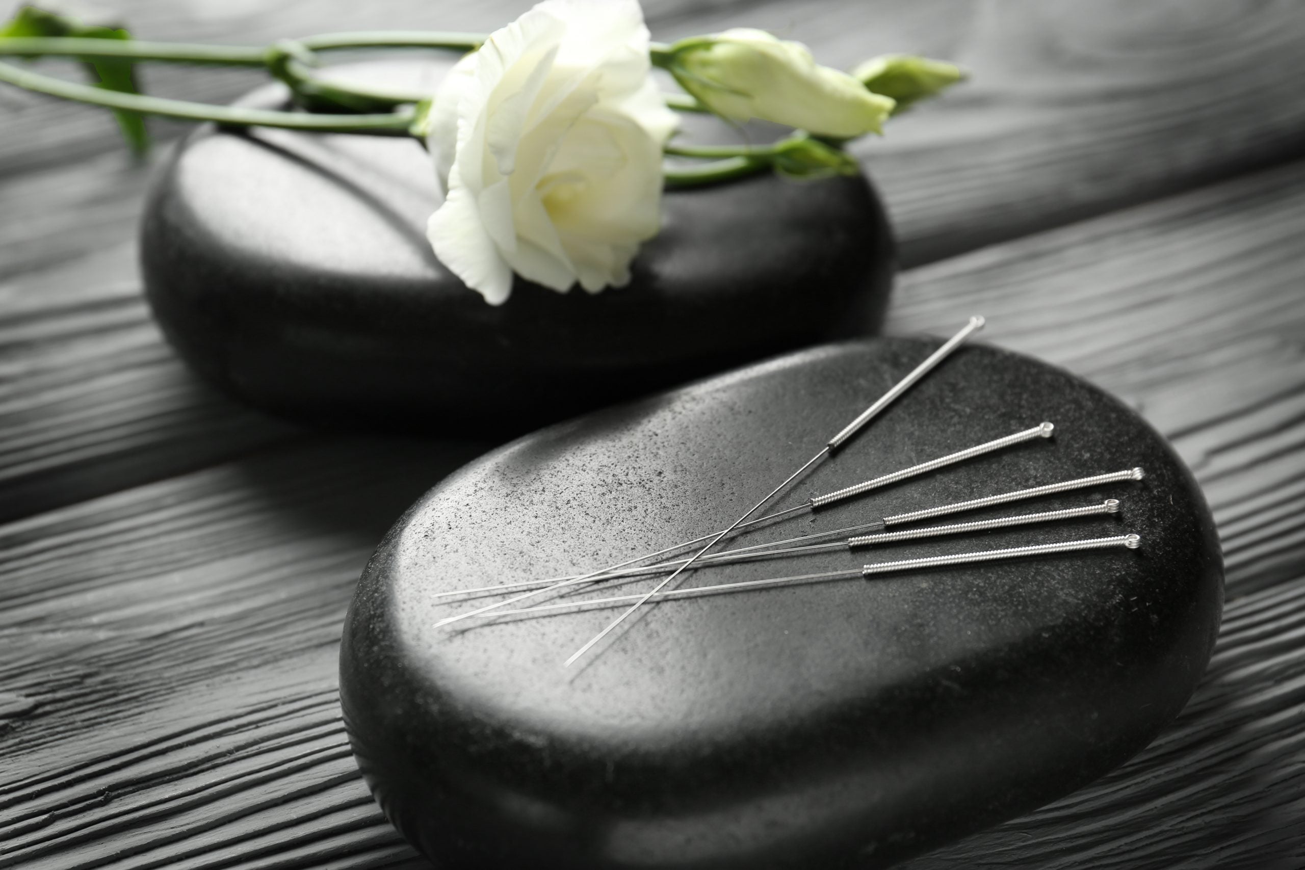 Unlocking the Health Benefits of Acupuncture