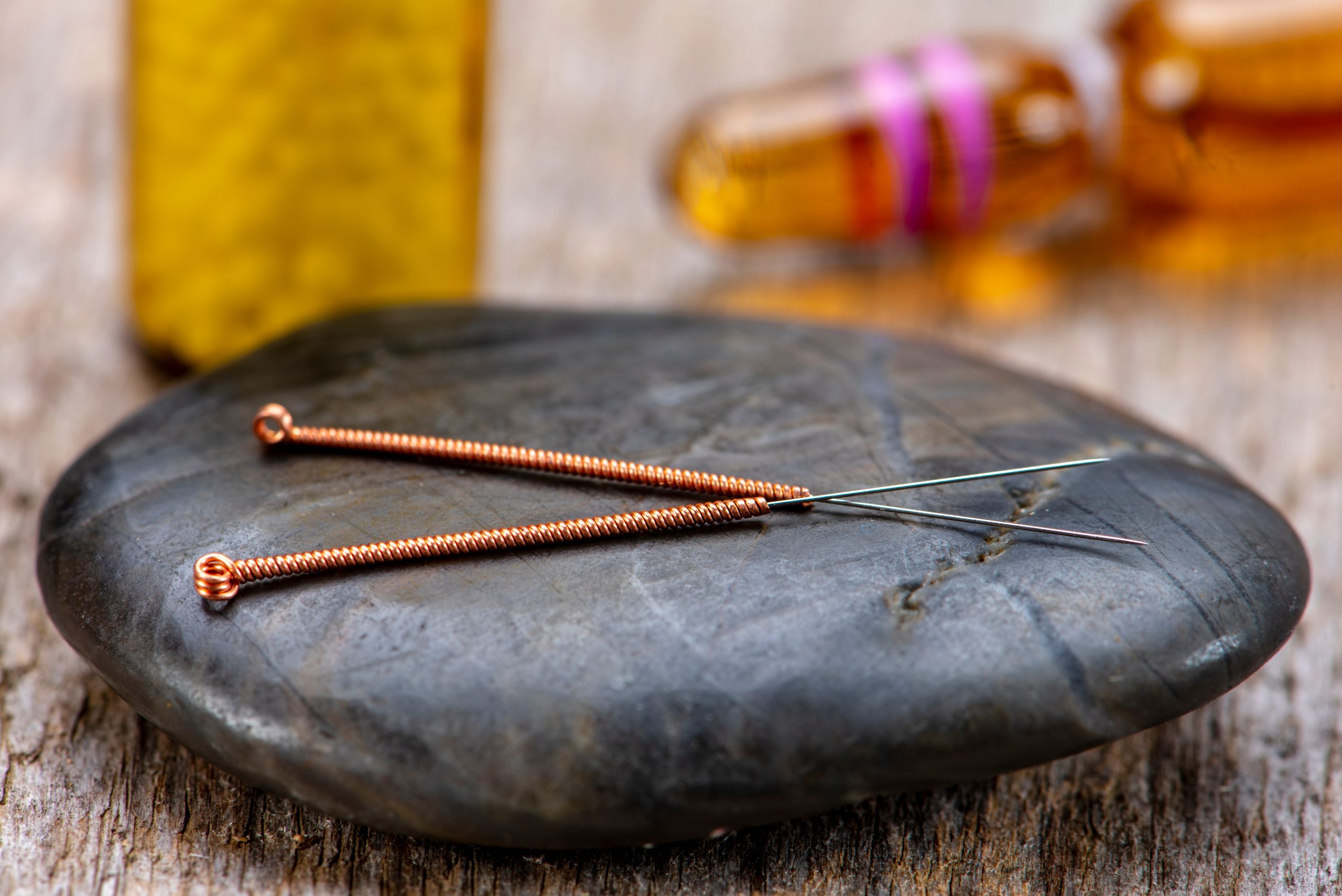 Relieving Pain with Acupuncture at AcuMedGroup