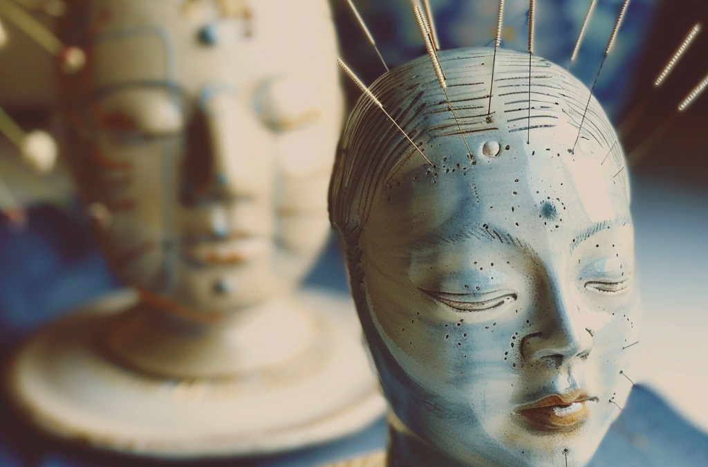 Exploring the Different Styles of Acupuncture