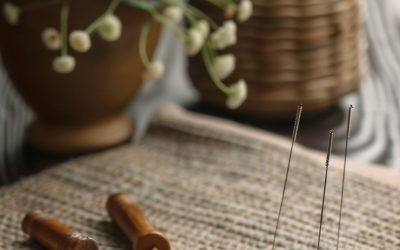 The Basics of Acupuncture: How It Works and What to Expect