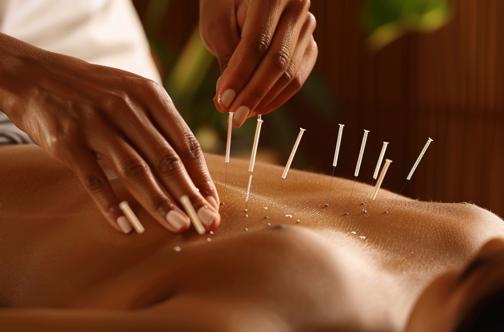 Top 5 Misconceptions About Acupuncture Debunked