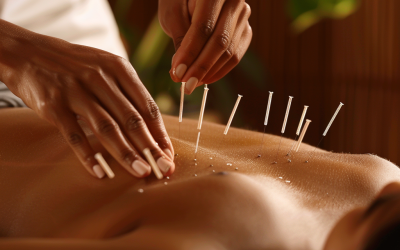Top 5 Misconceptions About Acupuncture Debunked