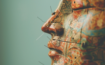 Acupuncture vs. Western Medicine: Complementary Approaches to Health