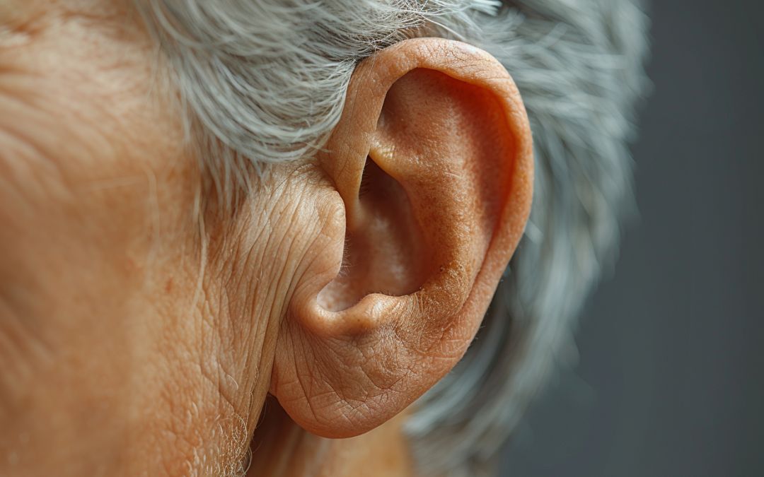 Acupuncture for Tinnitus: Ringing in Relief