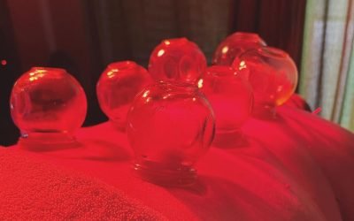The Art of Cupping Therapy: Complementing Acupuncture for Holistic Healing