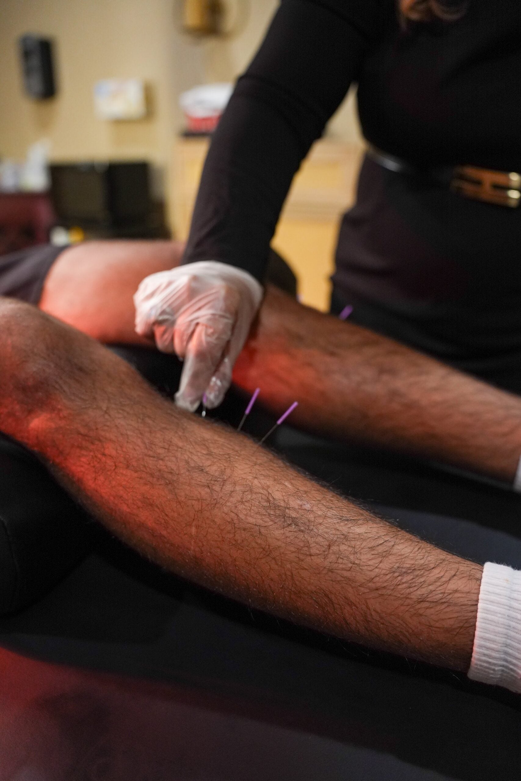 Acupuncture for Sciatica in Kissimmee, FL: A Drug-Free Path to Relief