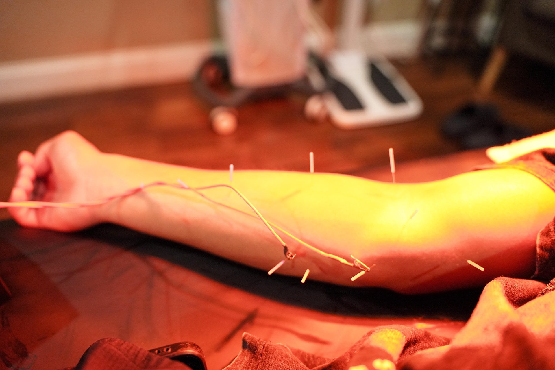 What VA-Covered Acupuncture and Pain Treatments at AcuMedGroup Mean for Veterans